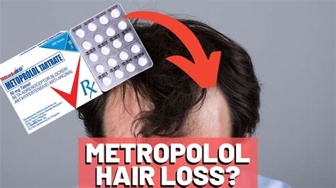 beta blockers hair loss|Concerns With Metoprolol Causing Alop.